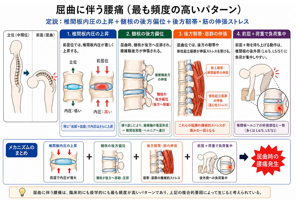 腰椎屈曲(骨盤後傾)で起きる腰痛のメカニズム