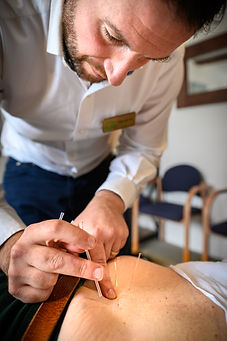 Philip Dry Needling.jpg
