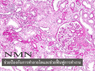 NMN ช่วยป้องกันการทำลายไตและช่วยฟื้นฟูการทำงาน