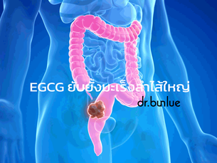 EGCG ยับยั้งมะเร็งลำไส้ใหญ่
