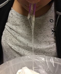 Sinus congestion discharge