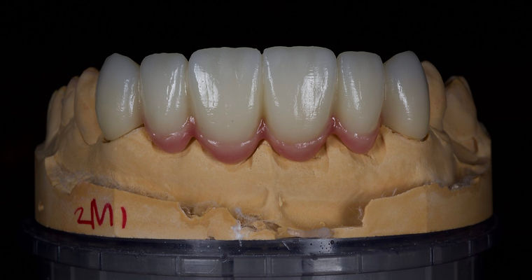 6-11bridgezirporlayeredandpinkpor.jpg