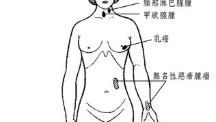 十六味流氣飲:扶正祛邪,行氣活血的綜合調養方