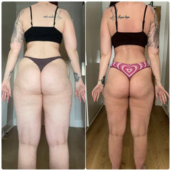 B&A D