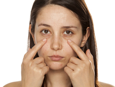 ¿Cansad@ de parecer cansad@? Ojeras.