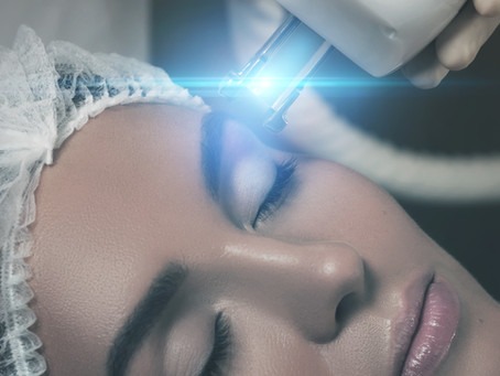 Cómo rejuvenece mi mirada el Láser, sin cirugía