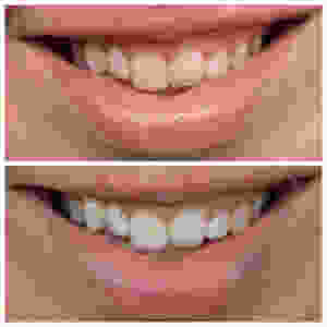 Smile Brilliant