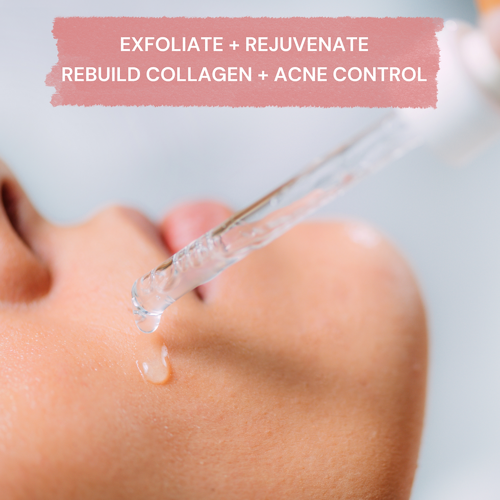 Thumbnail: Multi-Tasking Extra Strength Chemical Peel. Pure 5% Salicylic Acid + AHA