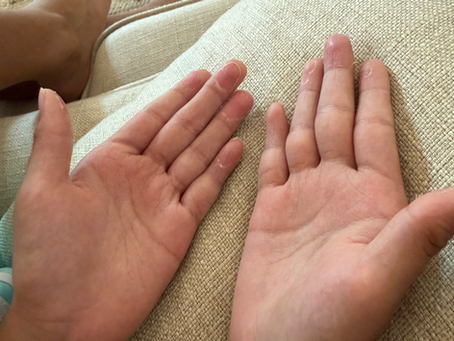 From Dry & Peeling to Calm & Comfortable: A Week with Sacred Lotion