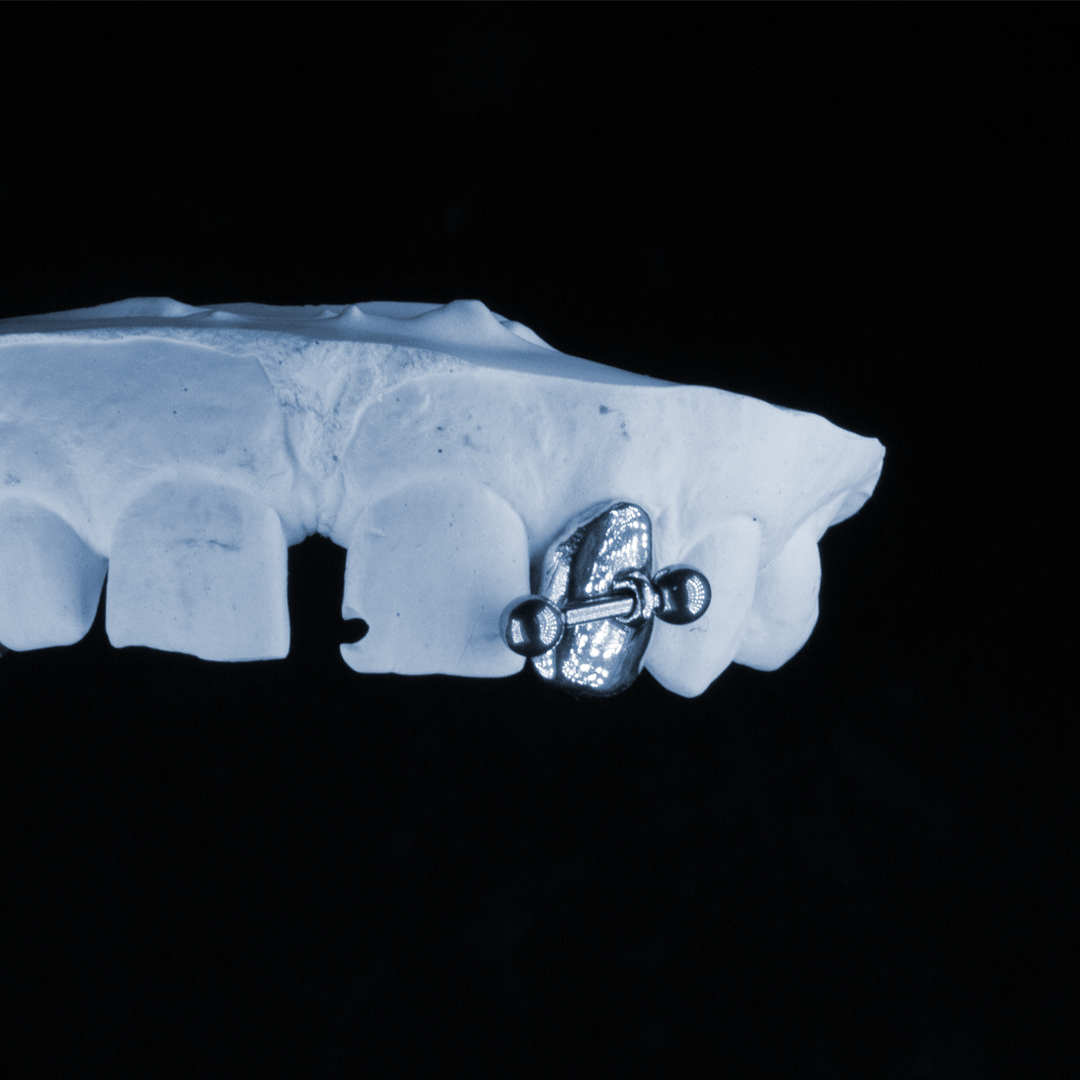 Staff piercing grillz