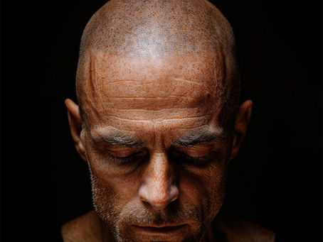 Why More People Are Opting for Scalp Micropigmentation (SMP) Over Hair Fibers and Hair Transplant.