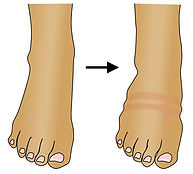 Swelling.JPG