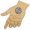 CarpalTunnel.JPG