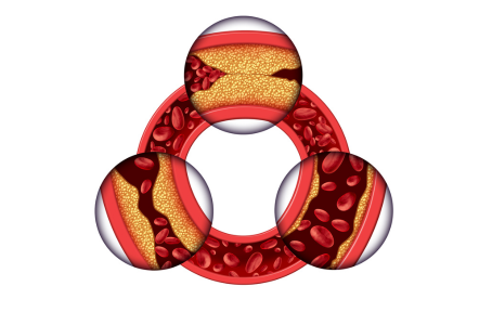 Arterien
