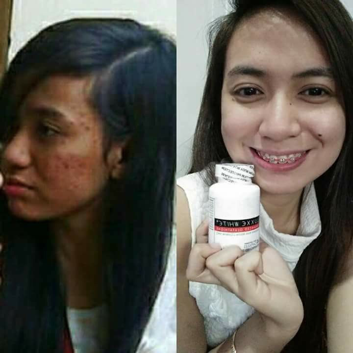 Thumbnail: LUXXE WHITE ENHANCED GLUTATHIONE