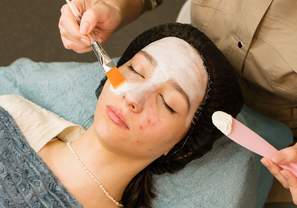 Acne Treatment Facial