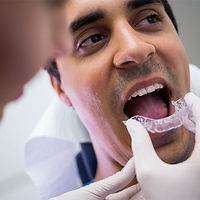Dental mouthguard being fitted