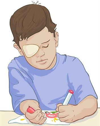 Eye patching at Singla Eye Hospital, Fauji Road, Kotkapura