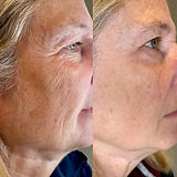 Polynucleotide results