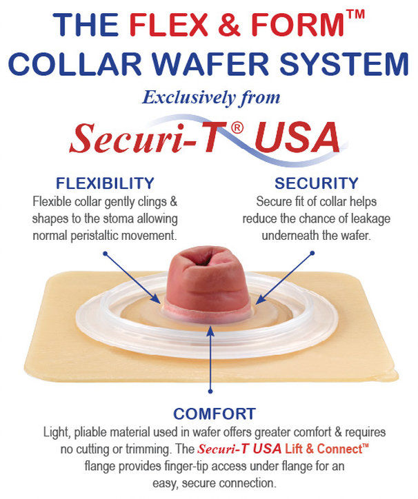 Ostomy Leakage What can I do?