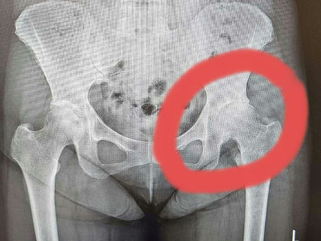 入院二十八日目