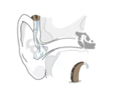 Contour d'oreille