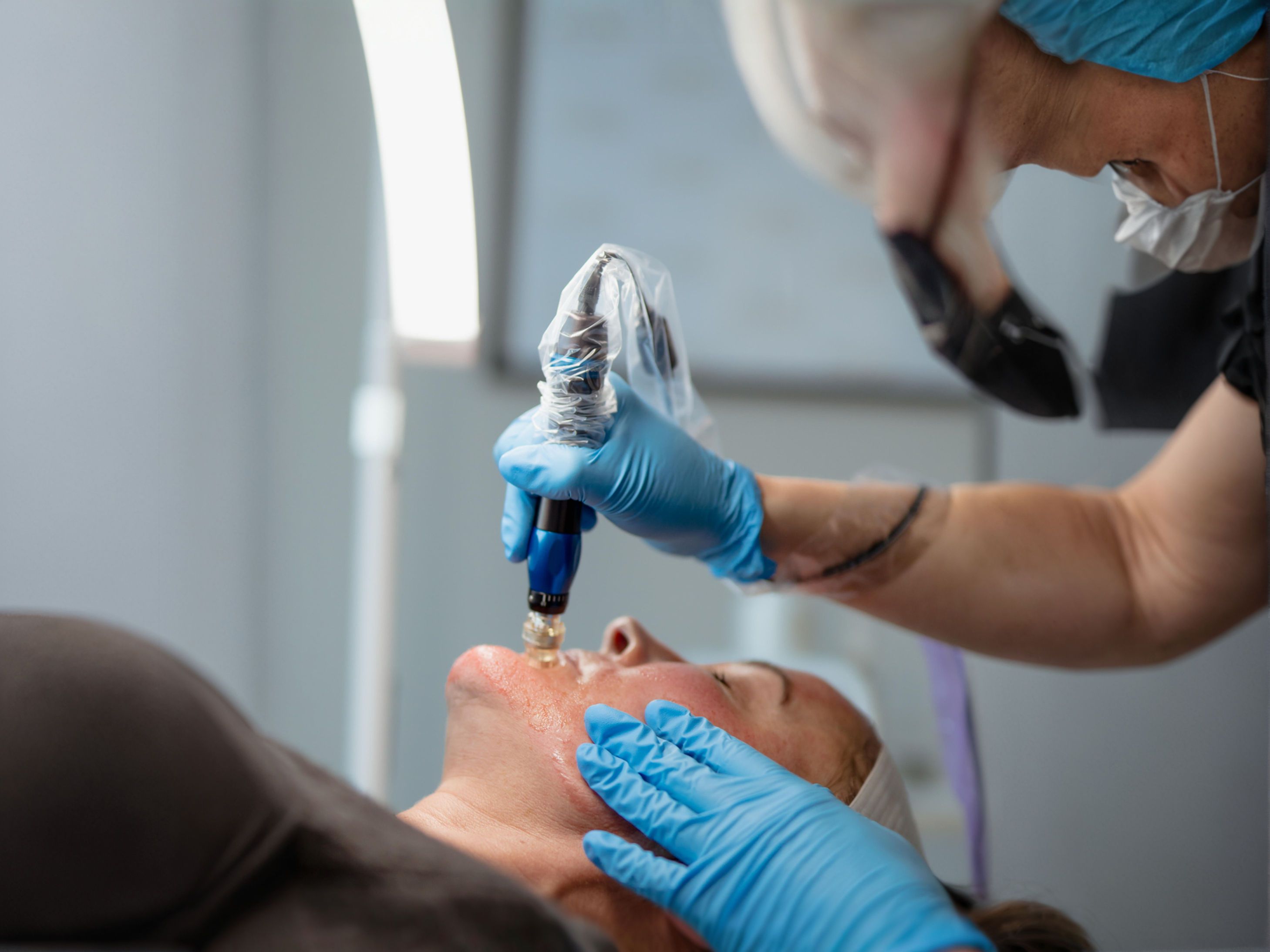 VAMPIRE FACIAL (3 PACK)