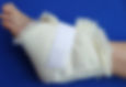 Thumbnail: Elbow / Heel Protector