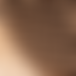 微粒子留著方案