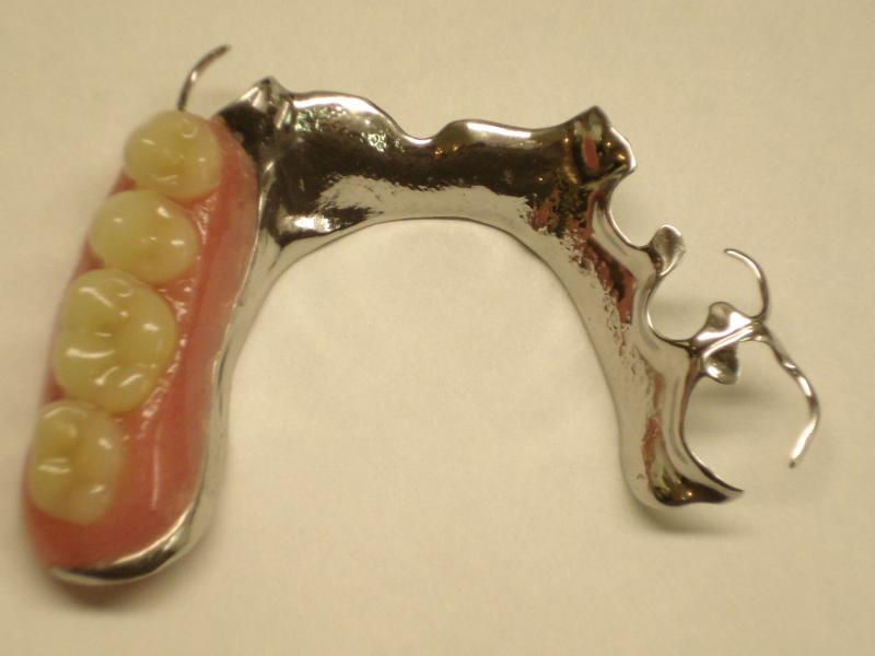 partial denture