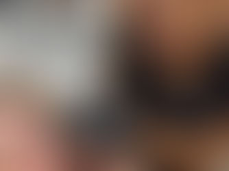 Treat under eye bags with PDGF at Perfectly Bare Laser with our expert Derm Cosmetic PA.