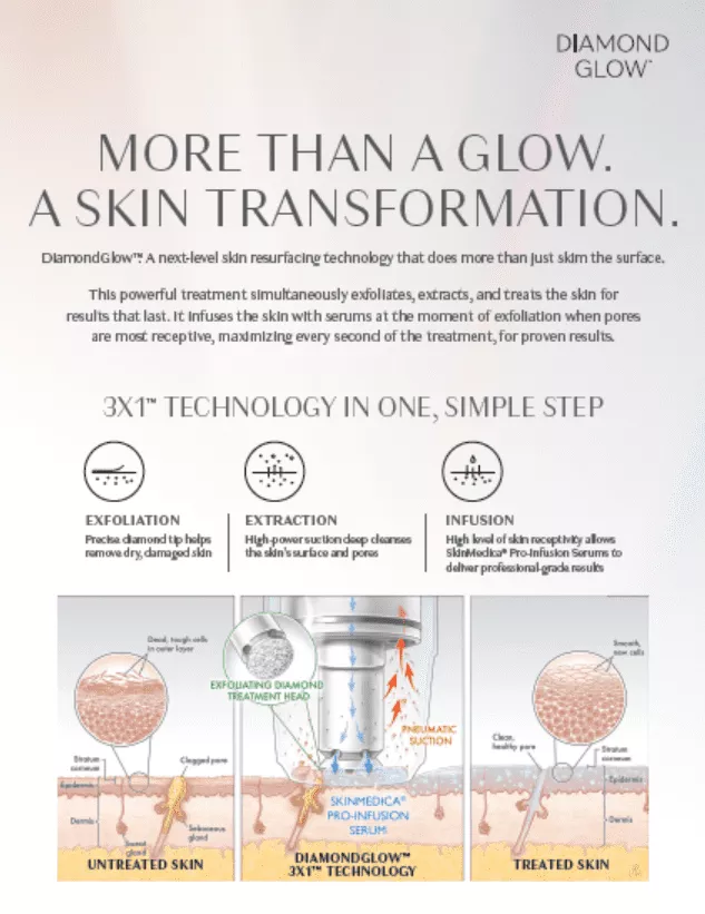 Diamondglow-Transformation-722.png.webp