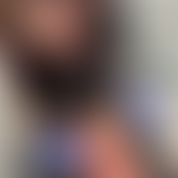 Unlocking Radiant Skin with Microneedling in Tampa