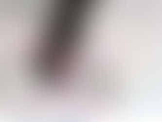 Why is the Alma laser system "virtually pain free"?