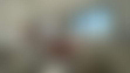 Tecnologia em Endodontia: Serviços avançados para sua saúde bucal