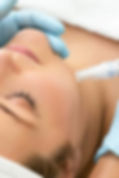 skinpen-microneedling-face-treatment