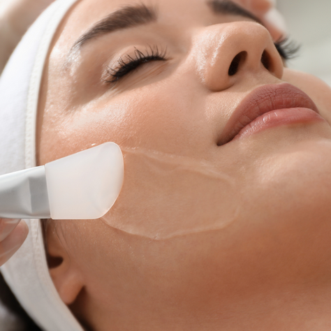 Acid Trip For Your Face: The Ultimate Guide to Chemical Peels