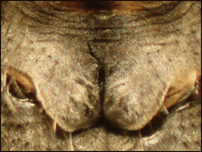 laph_diag3.gif