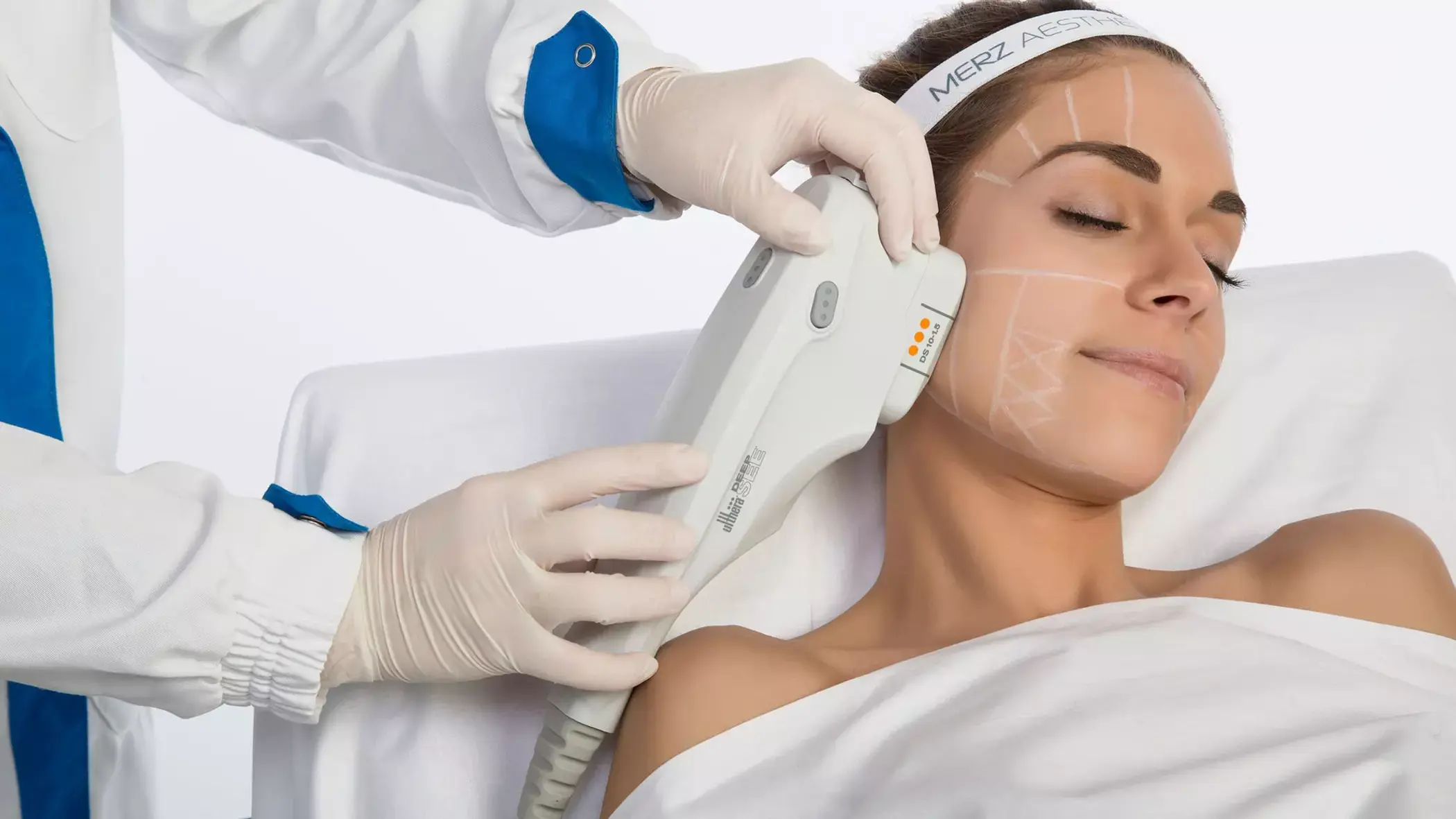 Ultherapy Lower Face +Neck Lift