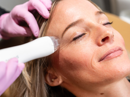 Your Skin Will Slay with Fractional RF Microneedling Dubai
