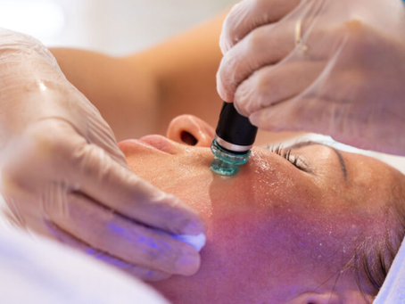 Hydrafacial Treatment Dubai Totally Transforms Your Skin Glow Game