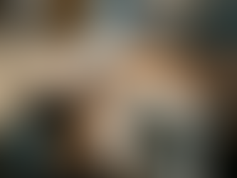 Hair Transplant for Receding Hairlines Rebuilding Natural Shape