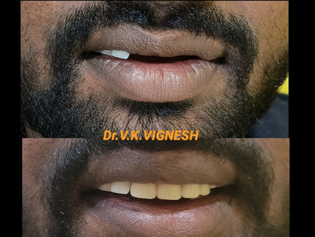 Are you searching for a best dental clinic in sembakkam ?