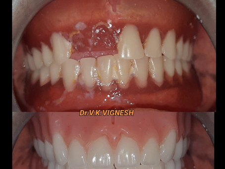 Dental Clinic in Santhosapuram