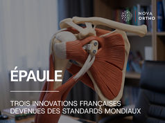 Chirurgie de l’épaule : comment les innovations françaises ont façonné les standards actuels