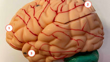 Major Parts of the Brain