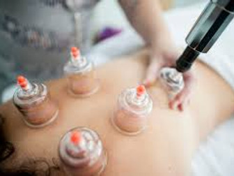 cupping image.1.jpeg