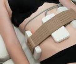 laser lipo.jpeg