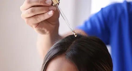 minoxidil-1024x555.webp