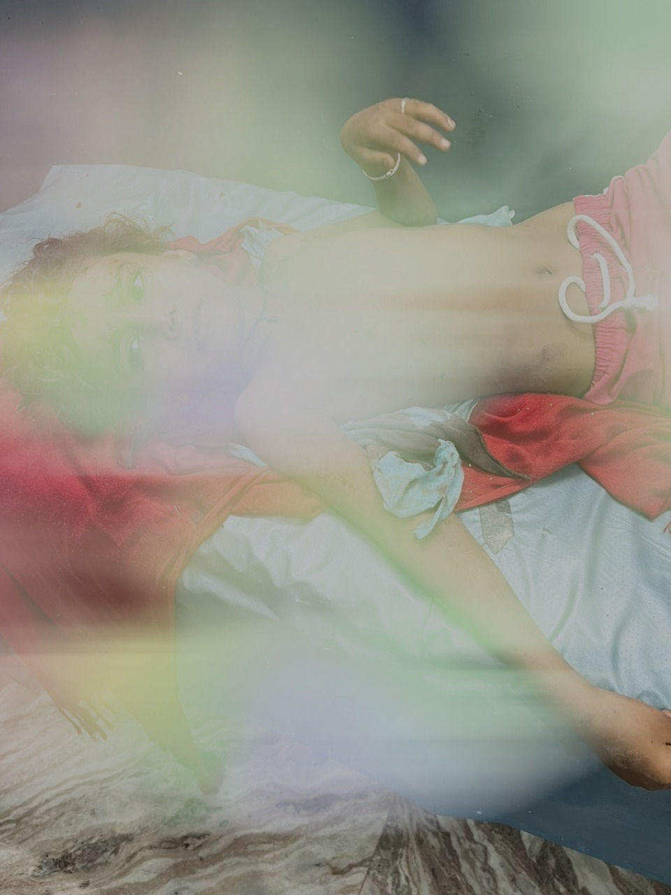 कुत्तों द्वारा नोंची गई बुलबुल की असली फोटो आपको परेशान कर सकती है इसलिए हमने उस फोटो को यहां अपलोड नहीं किया